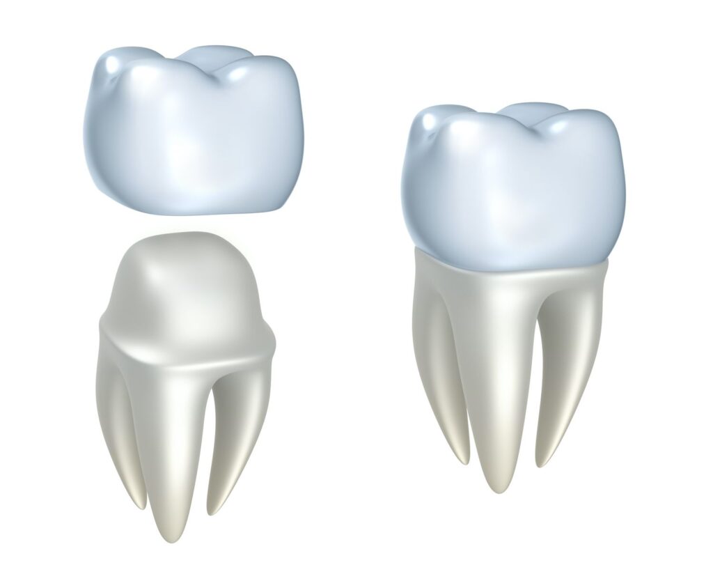 dental crown restorative benefits