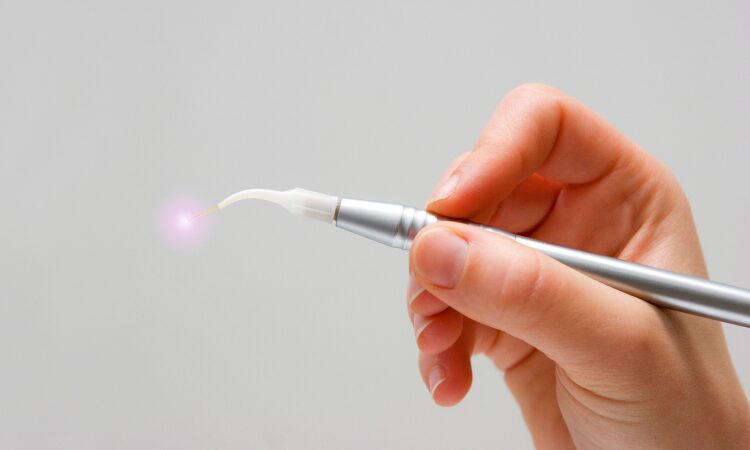 Laser dentistry has revolutionized the way dental treatments are performed, offering a modern, less invasive approach to oral care.